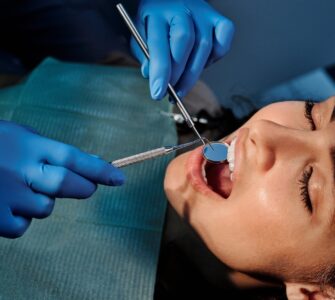 a person wearing blue latex gloves holding a mirror in a woman s mouth